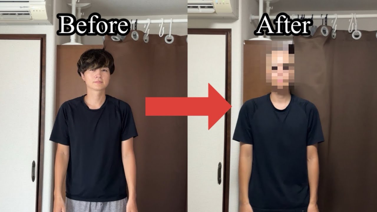 【五厘刈り】実はハゲていたので、坊主にしてみた