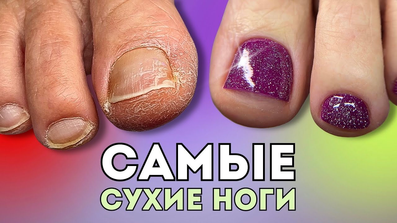 Таких сухих ног вы ещё не видели… Полное преображение 🧼🫧