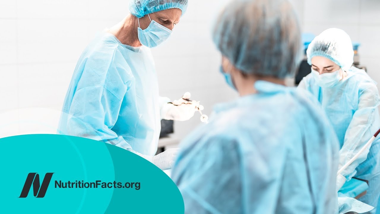 The Complications of Bariatric Weight Loss Surgery