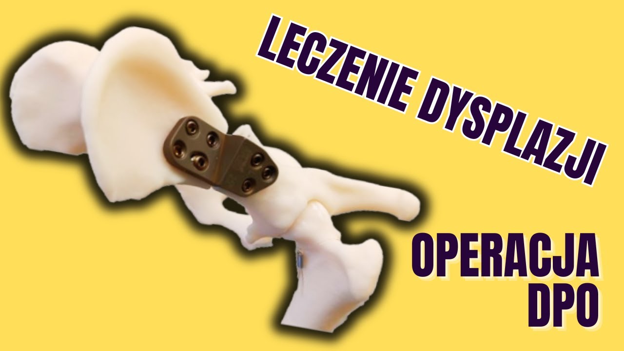 Na czym polega operacja DPO - podw&oacute;jna osteotomia miednicy u psa? Dysplazja staw&oacute;w biodrowych.