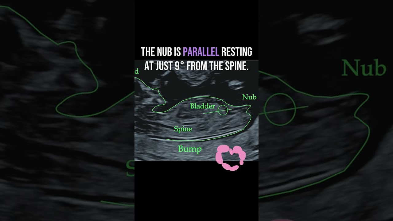 Gender reveal with NubX!