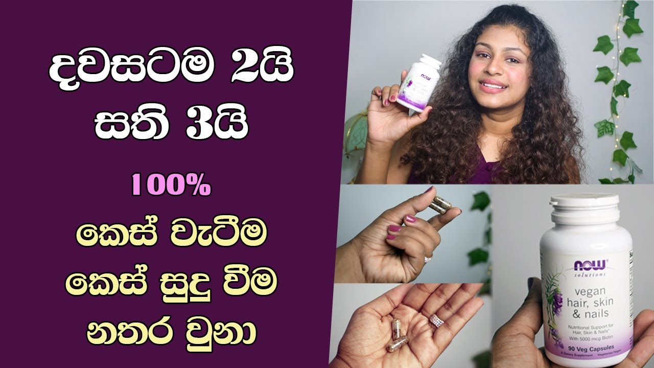 සති තුනෙන් ප්‍රතිපල ගෙනාපු Supplement එක | Best Supplement to Reduce Hair Loss and Grey Hair