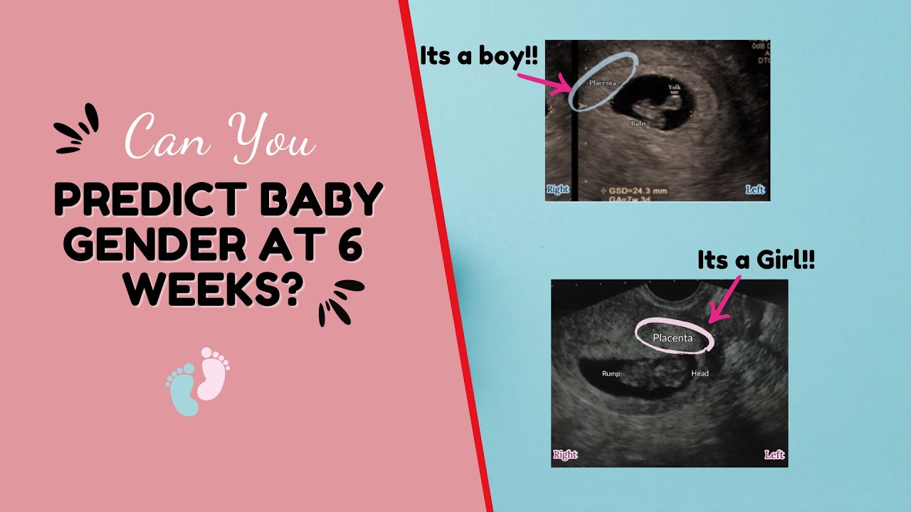 Can You Detect Baby's Gender at 6-8 Weeks Scan?  Boy or Girl?  The Ramzi Theory Gender Prediction