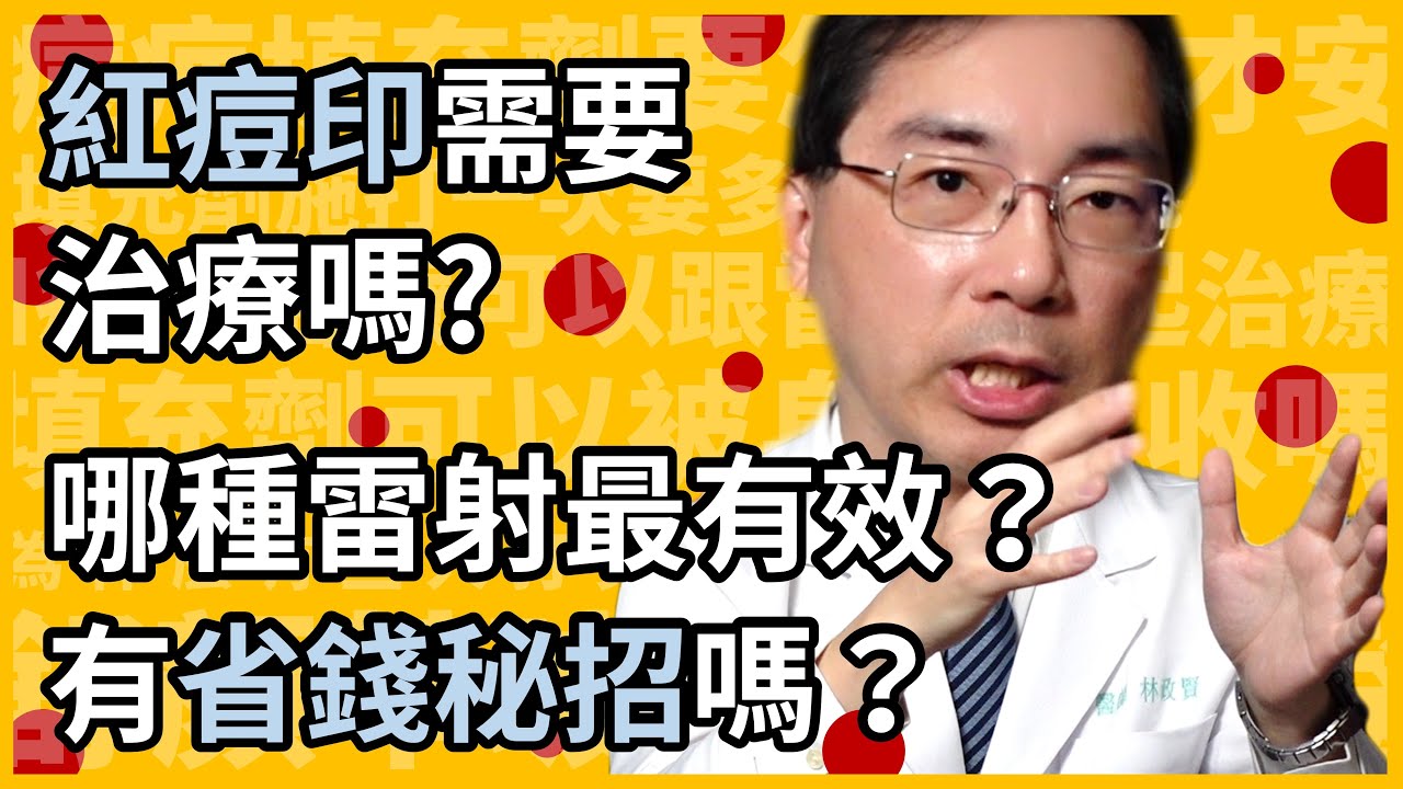 紅痘印 (紅痘疤) 需要治療嗎？消不掉怎麼辦？哪種雷射最有效？有省錢便宜高CP值的方法嗎？皮膚科醫師一次教你治療紅痘印的最強攻略！