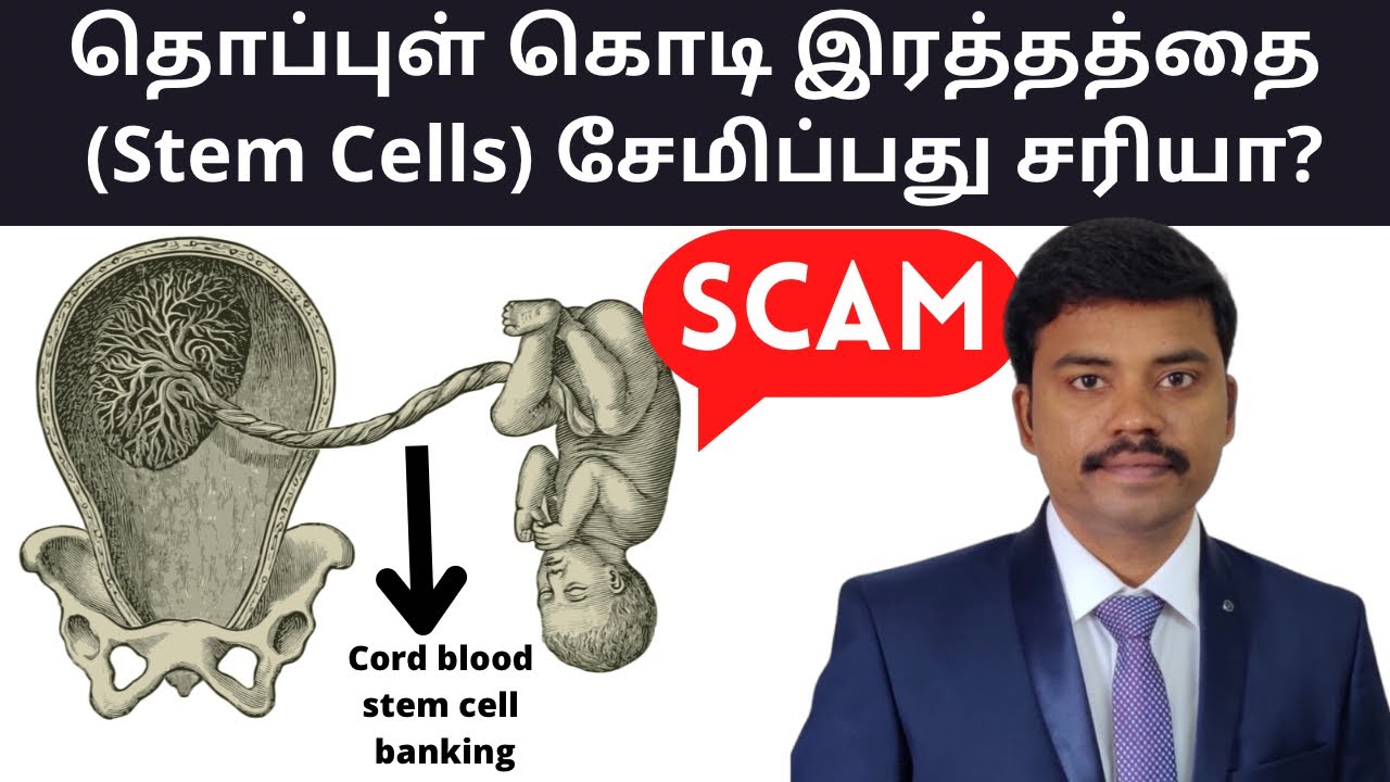 Umblical Cord Stem Cell Banking (தமிழ்) | Should we store our babies umblical cord stem cells?