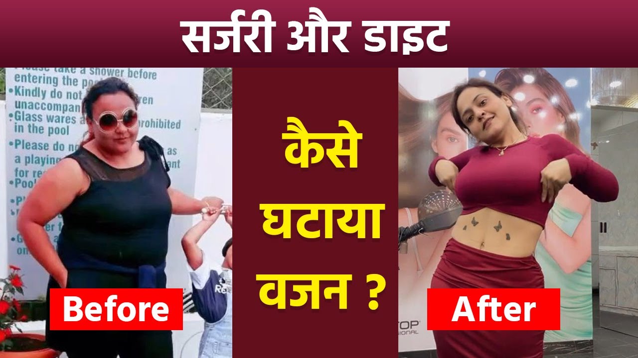 Nisha Lamba Weight Loss Journey And Diet Plan | Nisha Lamba Ne Weight Kaise Kam Kiya | Boldsky