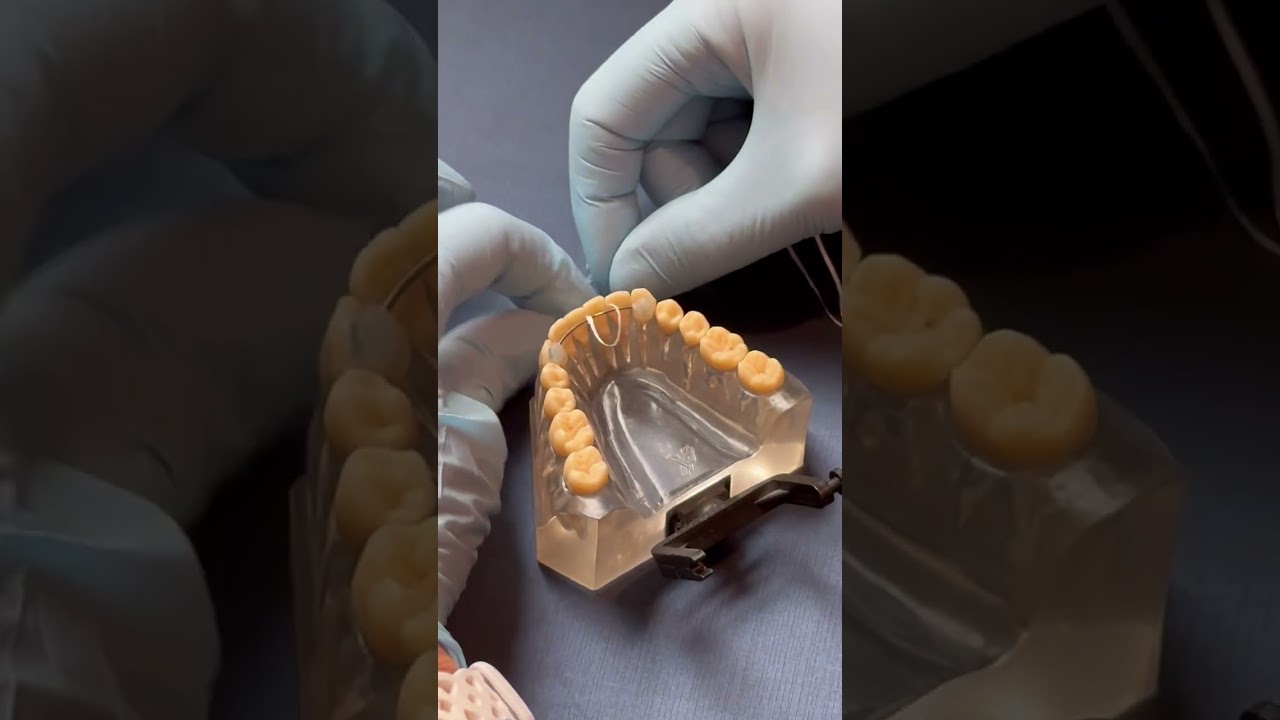 KFO How to Floss a Fixed Retainer