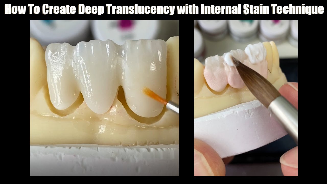How To Create Deep Translucency with Internal Stain Technique