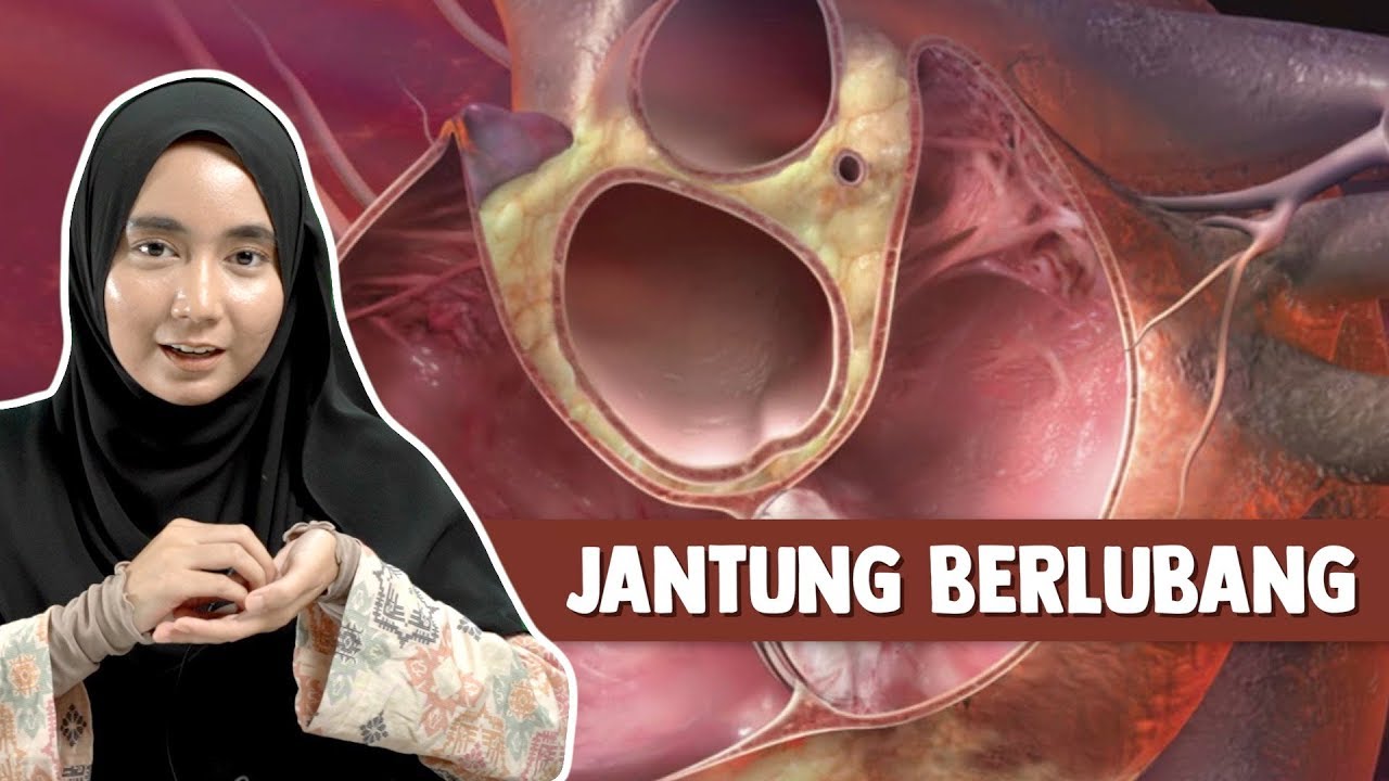 Jantung Berlubang