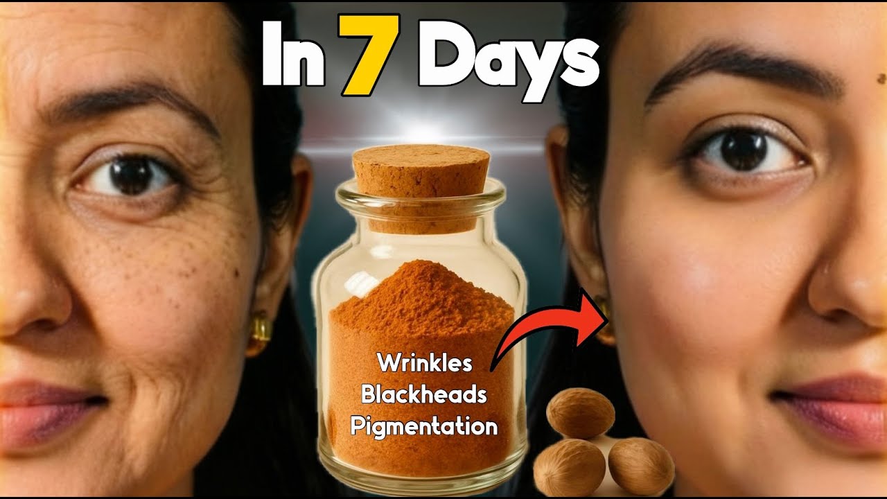 7 Days मैं Skin की सारी मुश्किल आसान - झाइयाँ Blackheads Whiteheads Hyperpigmentation Wrinkles Gone💕