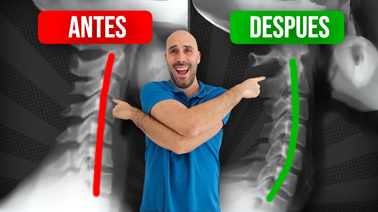 RECTIFICACIÓN CERVICAL rutina de EJERCICIOS para CORREGIRLA