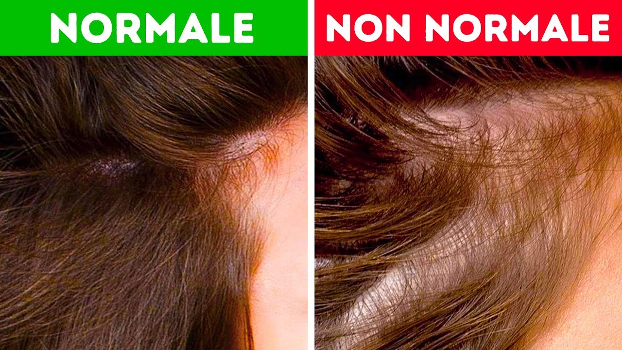 Scopri Cosa Possono Dirti i Capelli sulla tua Salute