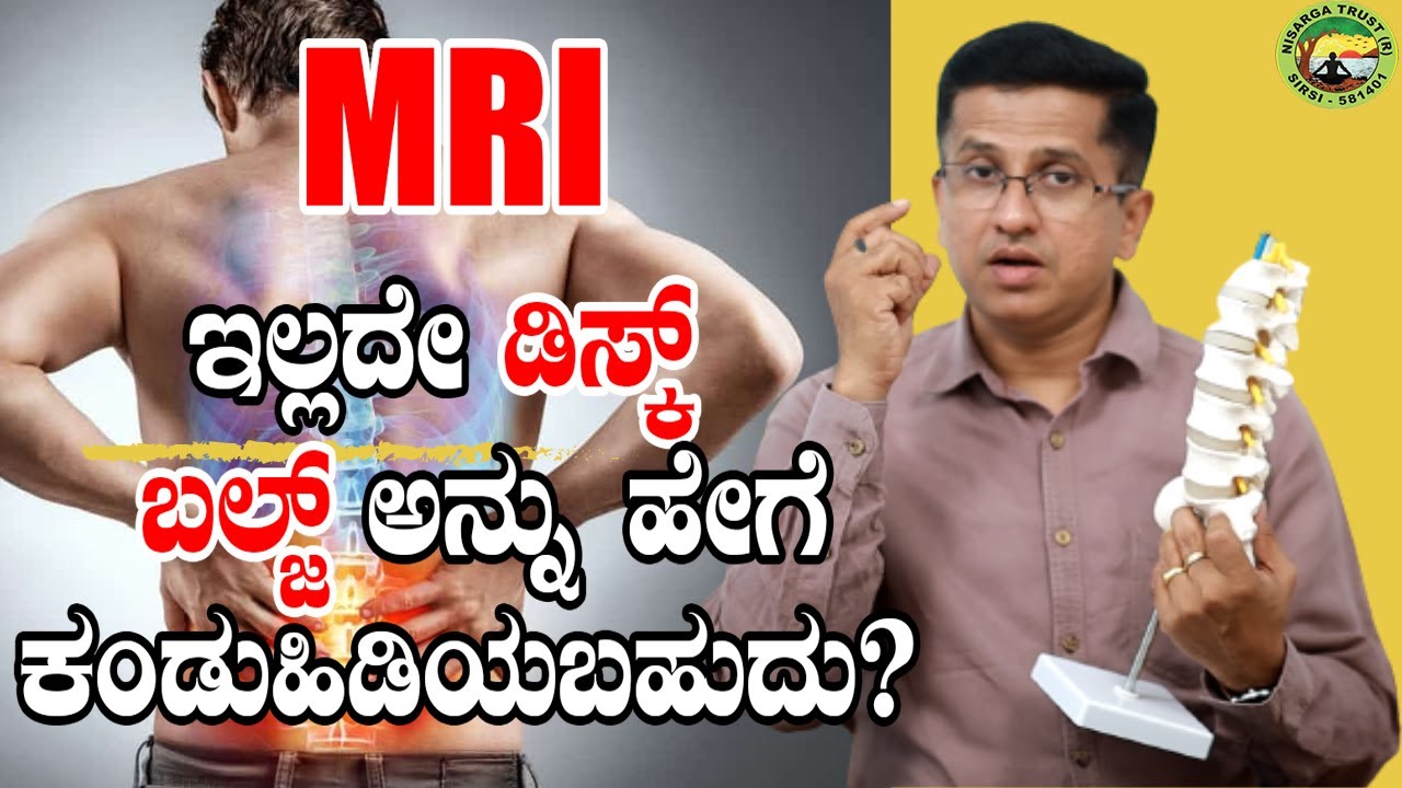 MRI ಇಲ್ಲದೇ ಡಿಸ್ಕ್ ಬಲ್ಜ್ ಅನ್ನು ಹೇಗೆ ಕಂಡುಹಿಡಿಯಬಹುದು?