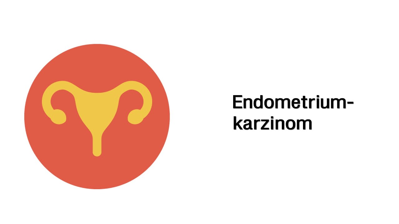 Endometriumkarzinom  - Erkrankungen der Geschlechtsorgane