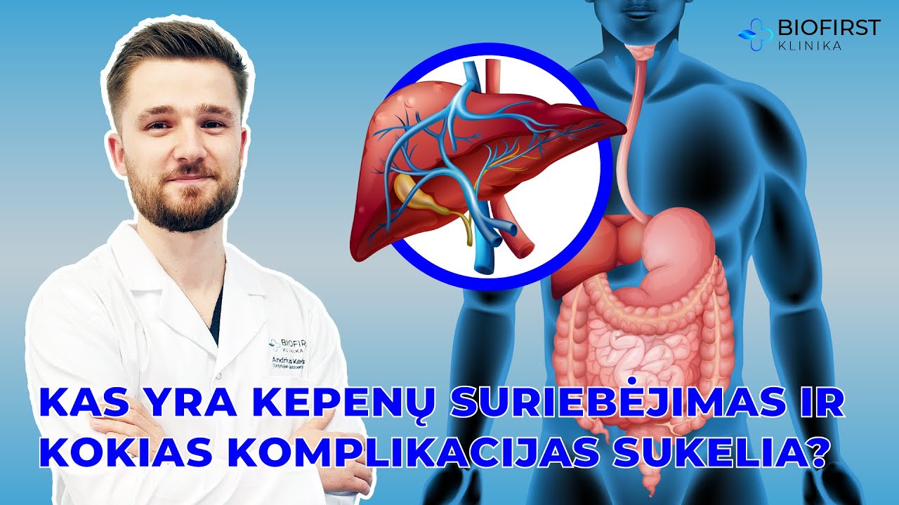 Kas yra kepenų suriebėjimas ir kokias komplikacijas jis sukelia? | Gastroenterologas A. Kederys