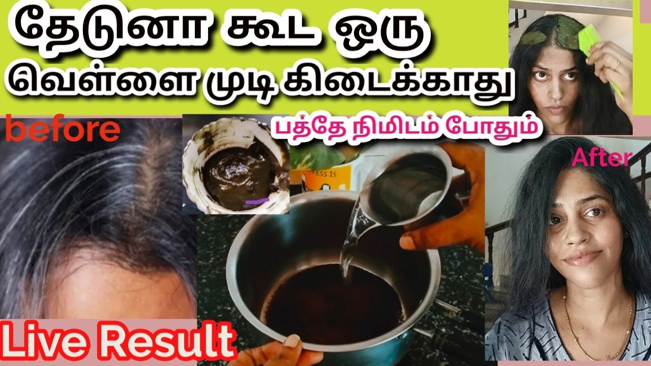 For herbal  hair growth oil watsapp 9842904988.Even after 6 months, the hair will remain black. 