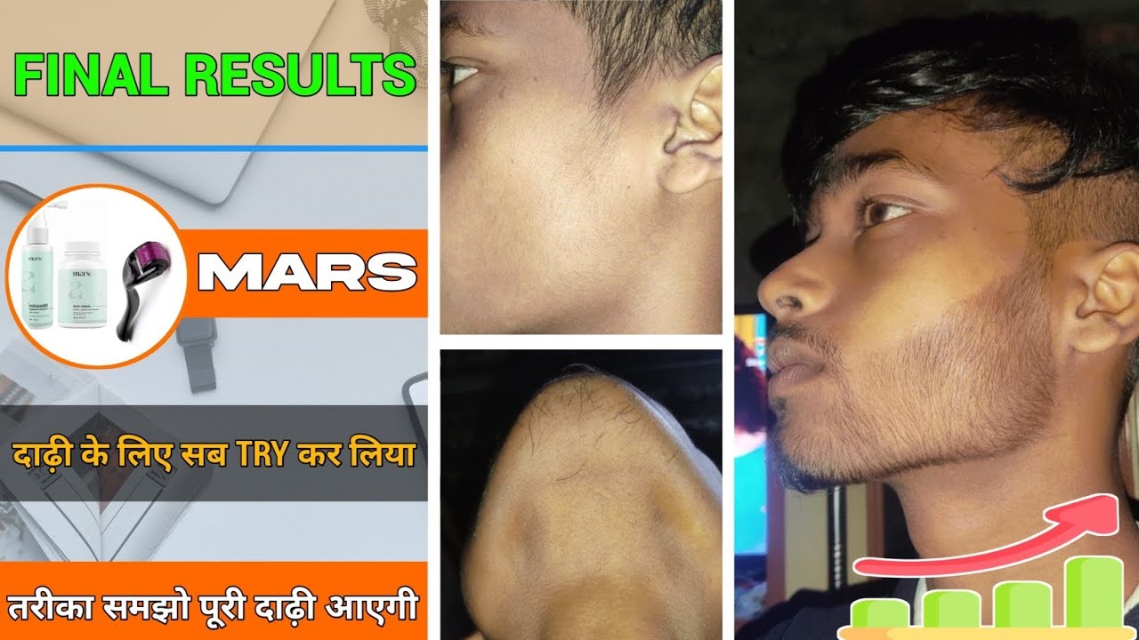 BEARD GROWTH □ Final results of beard (65) days ||  दाढ़ी के लिए सब TRY कर लिया || Best products ✨️
