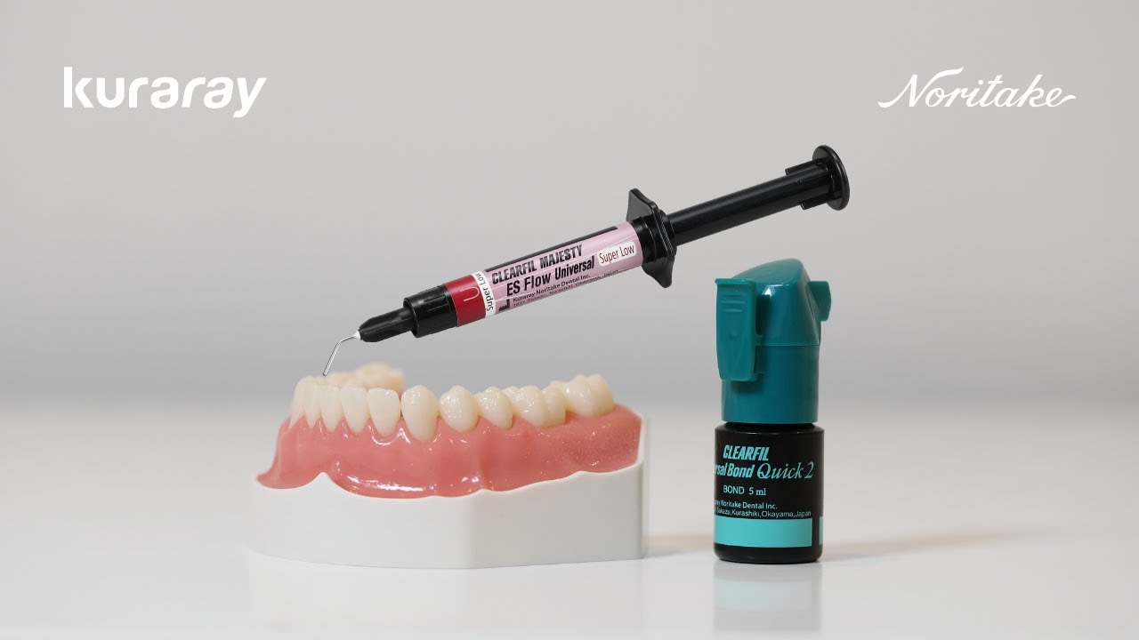 Direct restoration workflow | CLEARFIL Universal Bond Quick 2 + ES Flow Universal (Super Low)