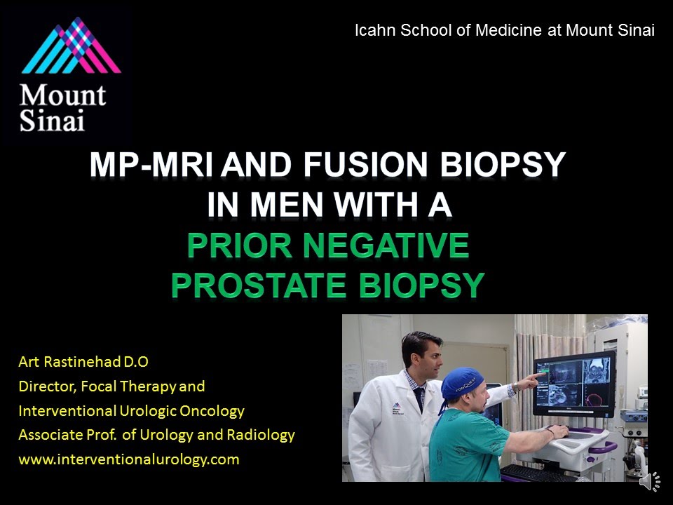 3   Rastinehad Negative Biopsy talk March 2015