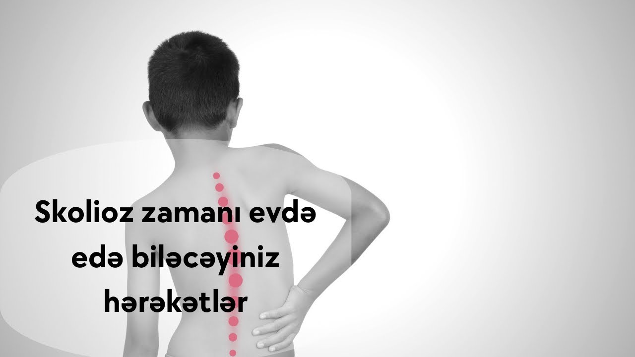 Skolioz zamanı evdə edə biləcəyiniz idman hərəkətləri | Fizioterapevt Aziz Davrishov