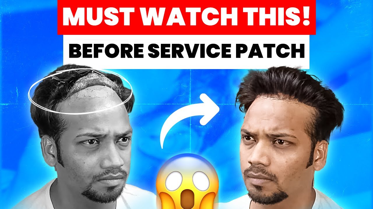 How To Service Hair patch At Home |  Self Service of Hair Systems