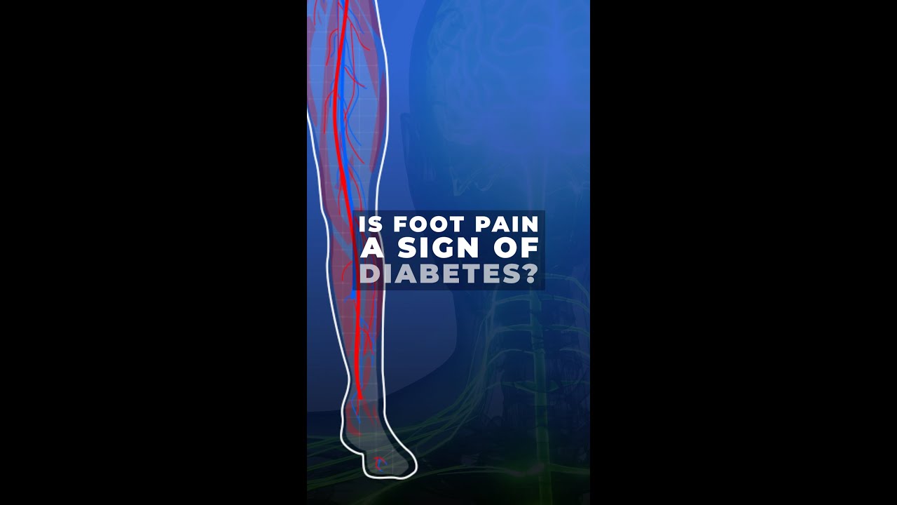 Is Foot Pain a Sign of Diabetes?