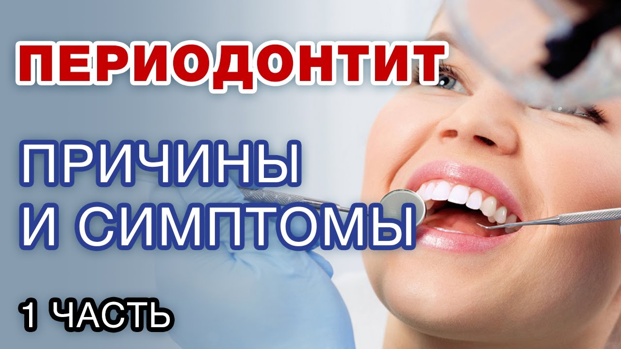 Периодонтит: основные симптомы / Как самому определить периодонтит по снимку зуба? Часть 1