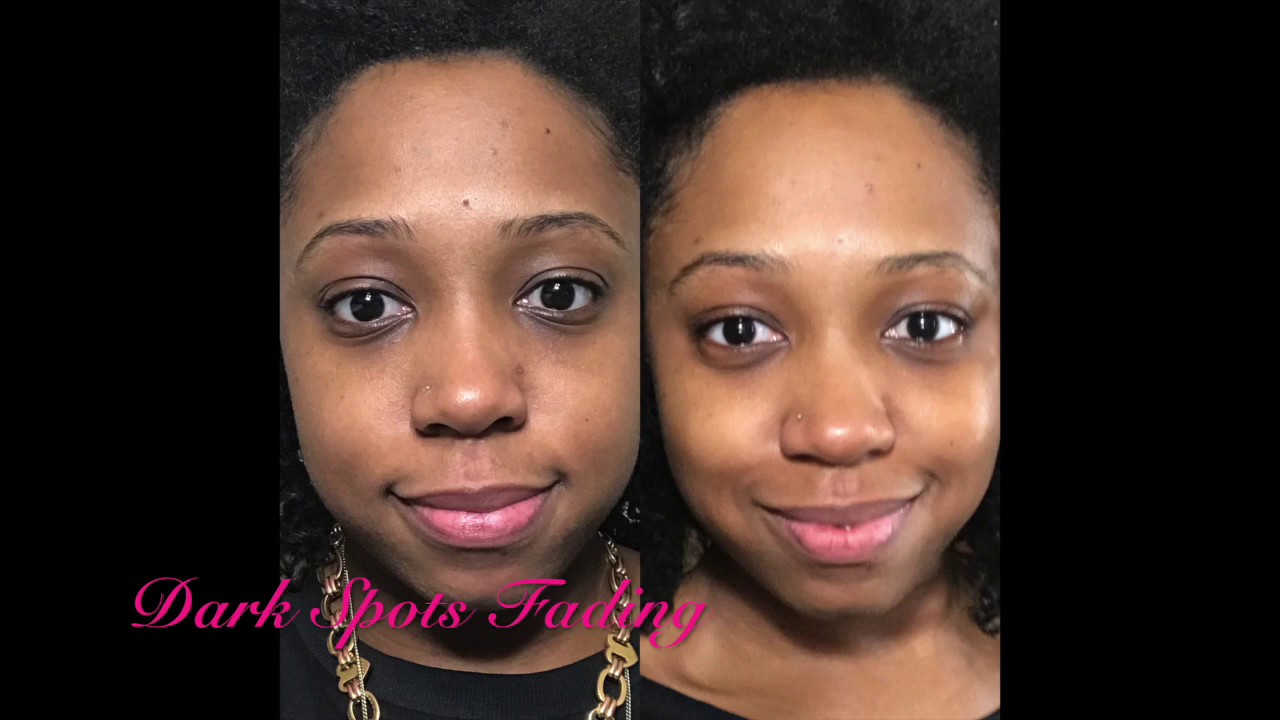 Neutrogena Rapid Tone Repair dark spot corrector