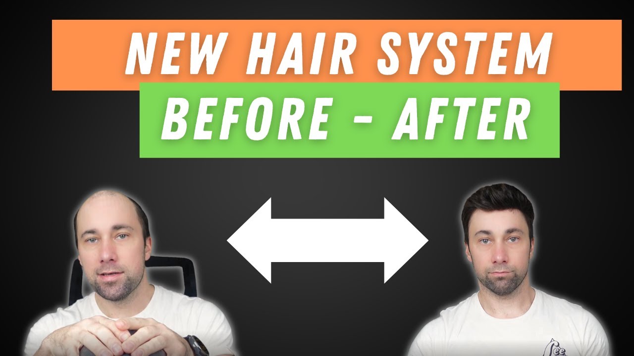 hair system | new hair for a new year