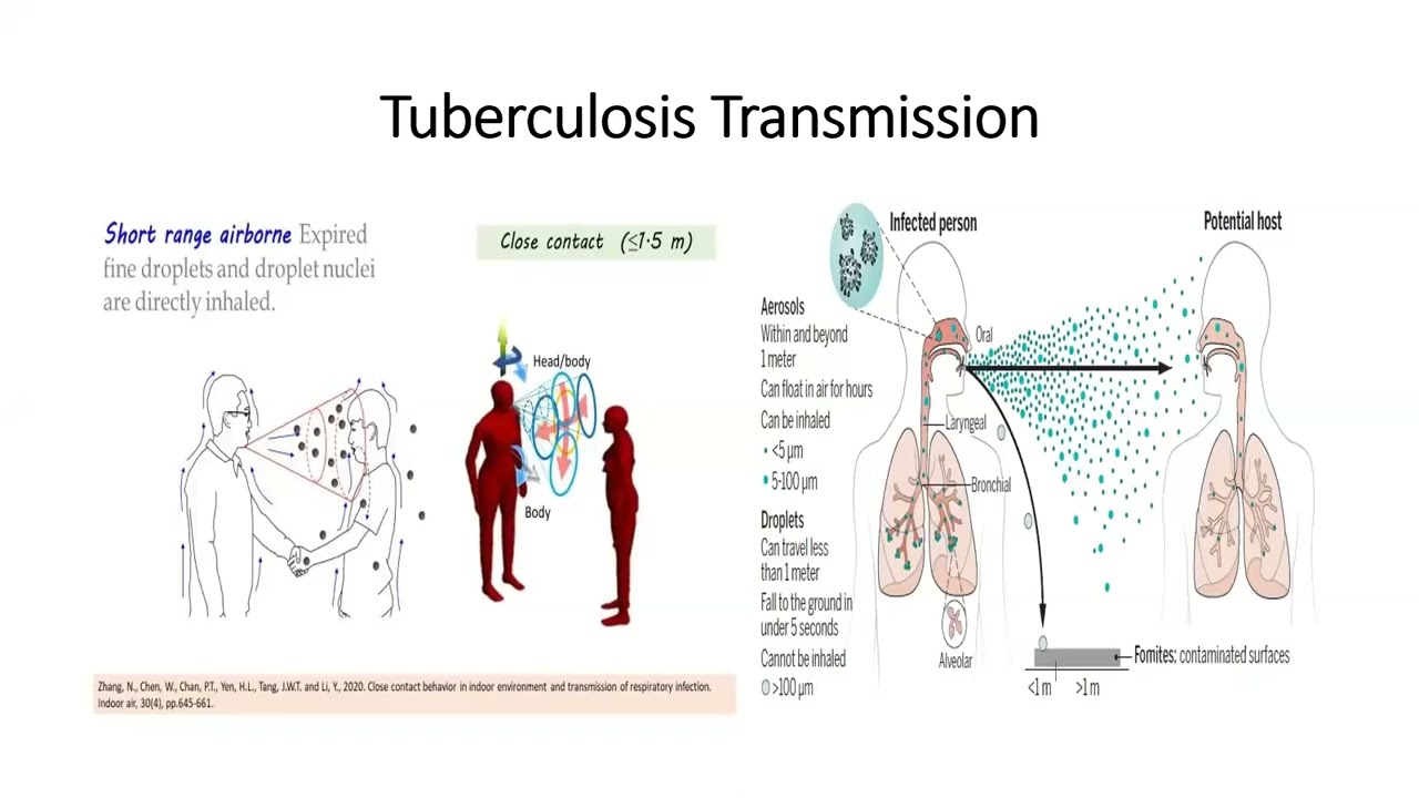 KNH-UoN Webinar : Infection Prevention & Control Practices in Tuberculosis Management
