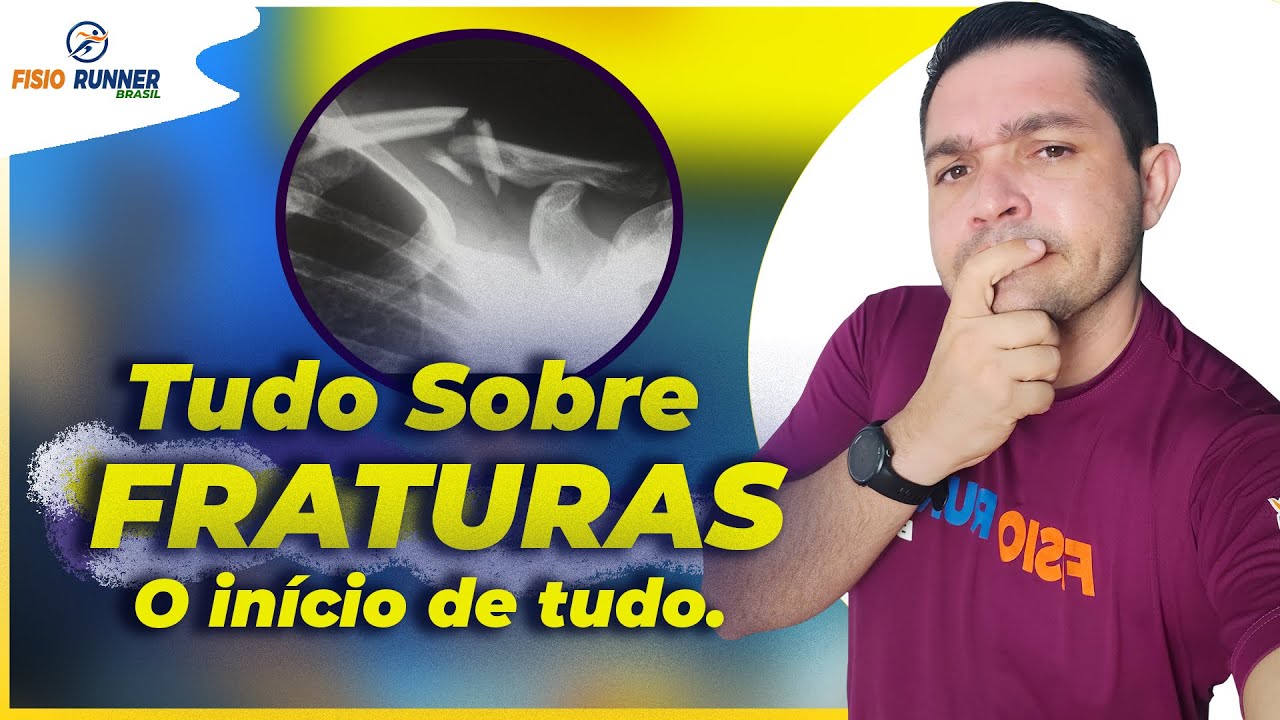 Tudo Sobre Recupera&ccedil;&atilde;o das Fraturas - AULA 01