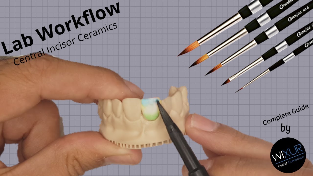 Ceramics Build-up (Layering Technique)