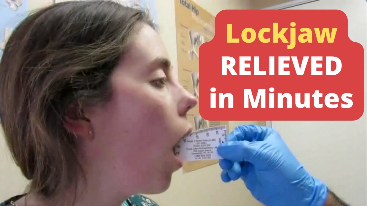 Unbearable Lockjaw Pain Unlocked Fast (THIS WORKS!!)