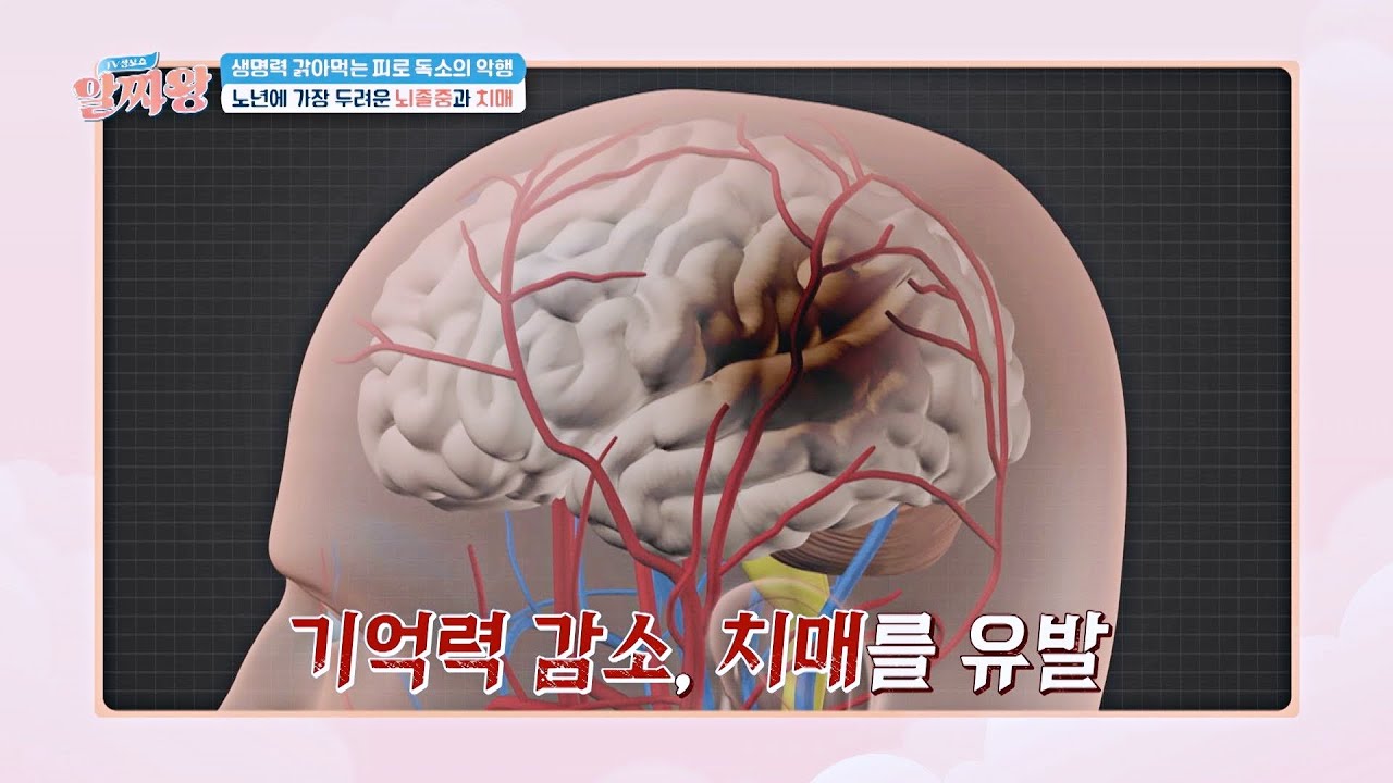 뇌혈관을 막는 만성염증의 악행, '뇌졸중과 치매' 유발🚨 | TV정보쇼 알짜왕 313회 | JTBC 230316 방송
