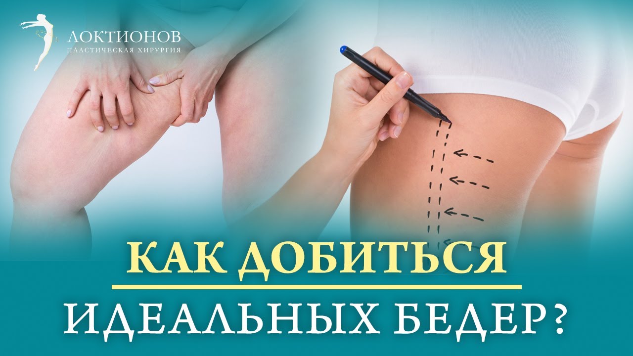 Как уменьшить бедра? Что такое феморопластика? Виды феморопластики. Как проходит операция?