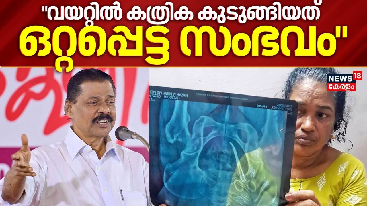 വയറ്റിൽ കത്രിക കുടുങ്ങിയത് ഒറ്റപ്പെട്ട സംഭവമാണെന്ന് CPM സംസ്ഥാന സെക്രട്ടറി | Medical Negligance