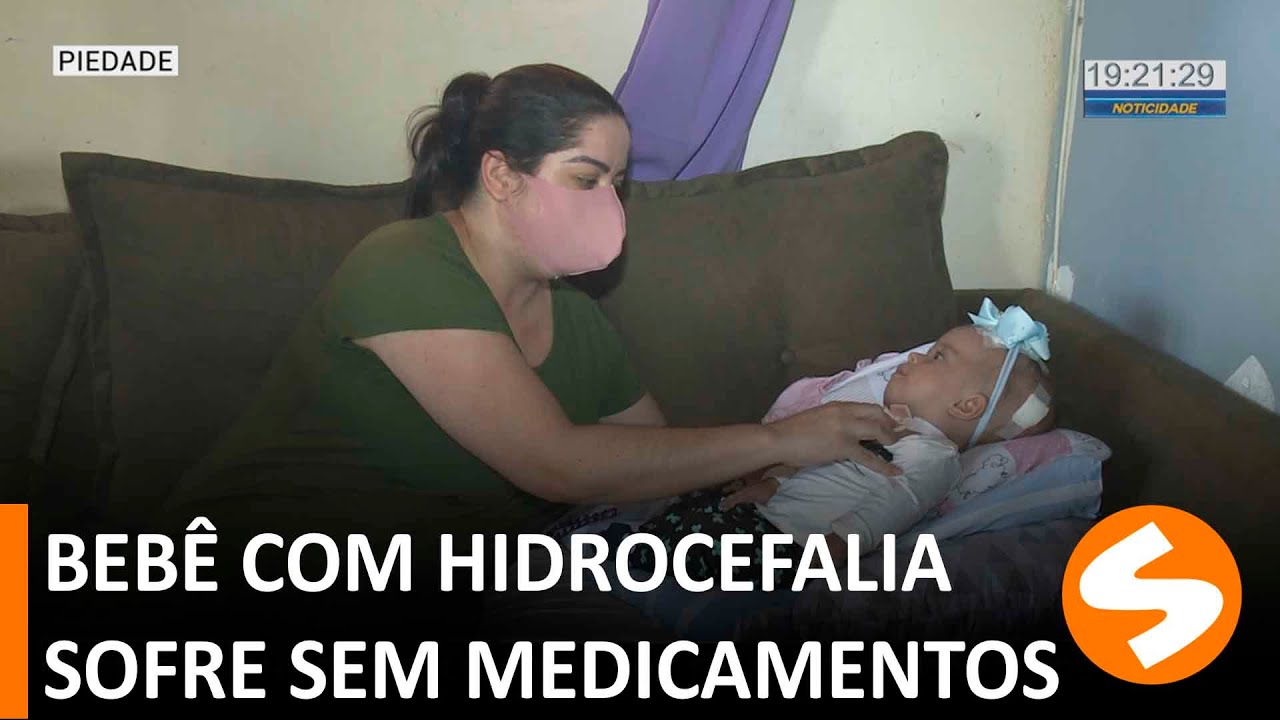 Bebê com hidrocefalia sofre com falta de medicamentos | TV Sorocaba SBT