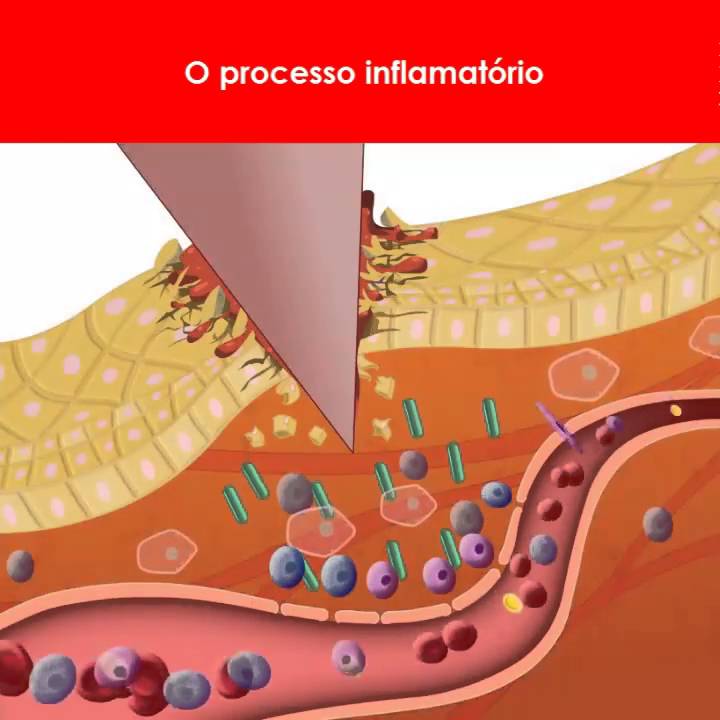 Processo Inflamatório