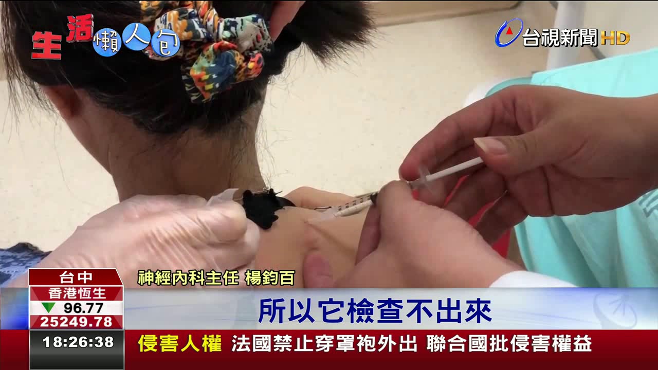 痛到背不出身分證字號肉毒桿菌治偏頭痛