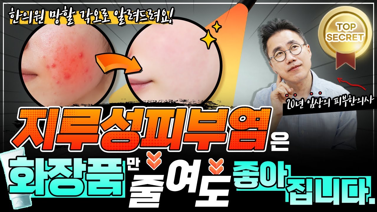 지루성피부염은 화장품 보습제만 줄여도 호전됩니다. 화장품 보습제 양도 줄이고 갯수도 줄이고