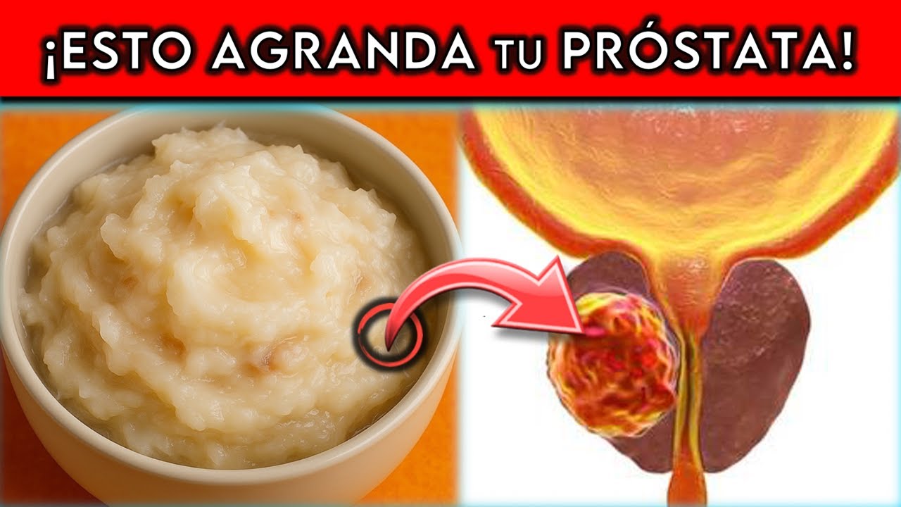 ALIMENTO #1 que AGRANDA tu PRÓSTATA y nadie te lo dice