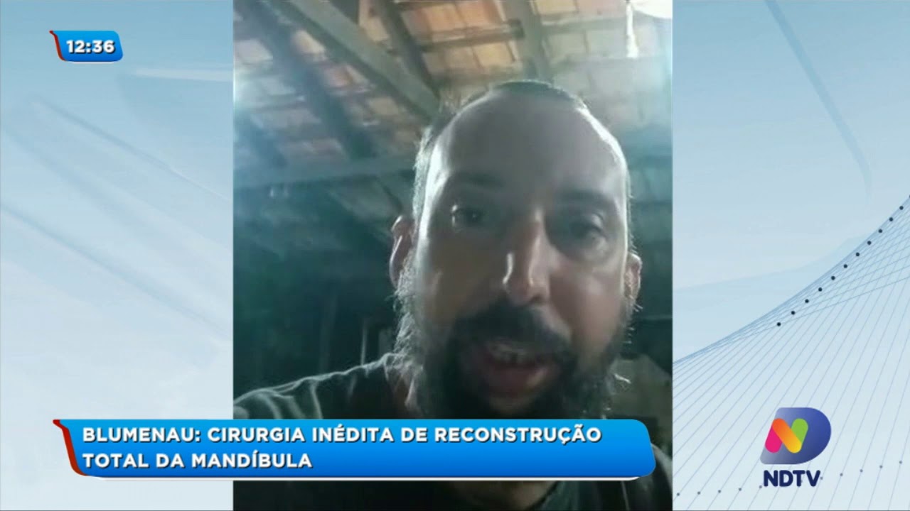 Blumenau: Cirurgia inédita de reconstrução total da mandíbula