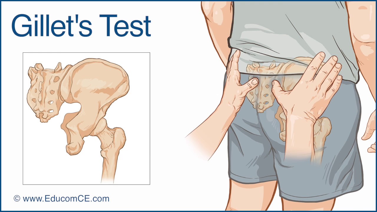 Gillet's Test for Sacroiliac dysfunction - Chiropractic Online CE&trade;