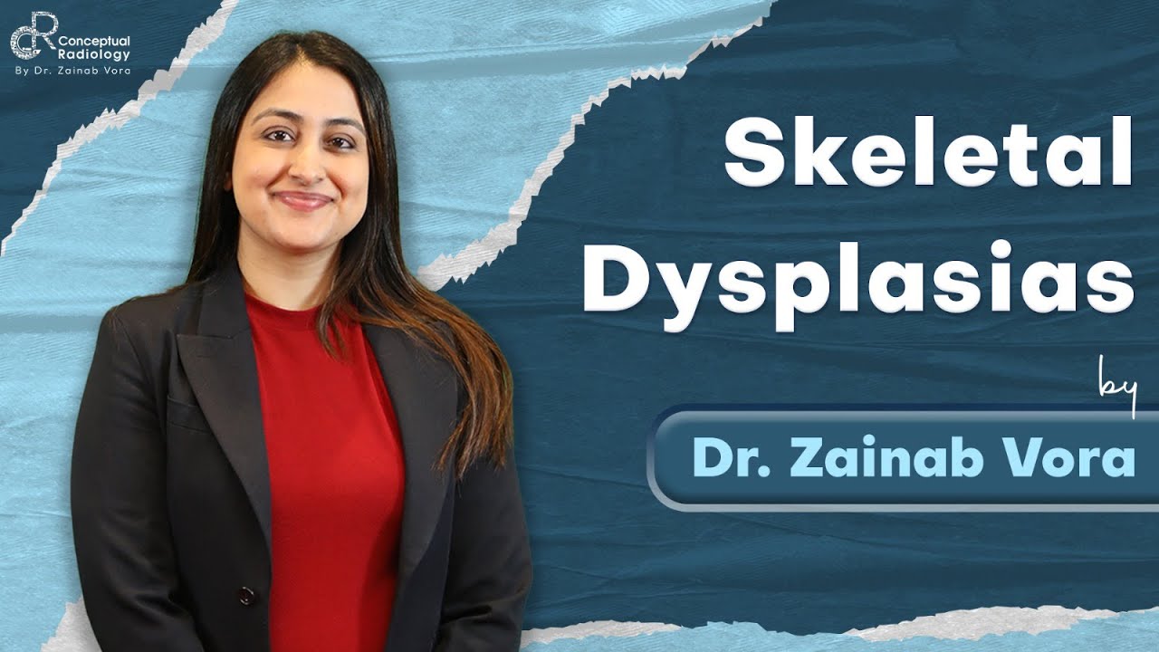 Skeletal Dysplasias Dr  Zainab Vora @ConceptualRadiology