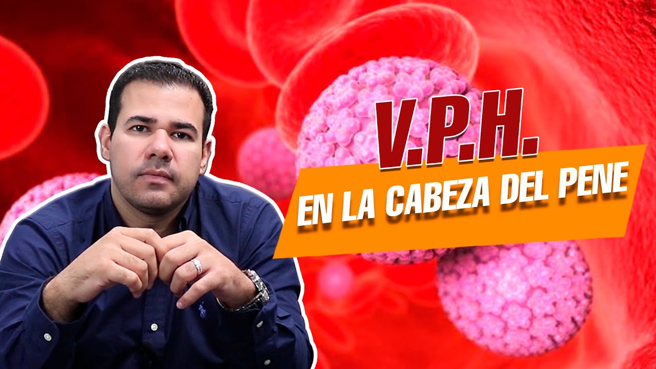 VPH en la cabeza del PENE