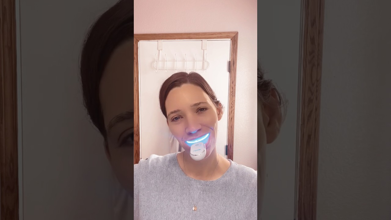 Fast LED Teeth Whitening Kit in 10 Min | MySmile Whitening with LED Light Review