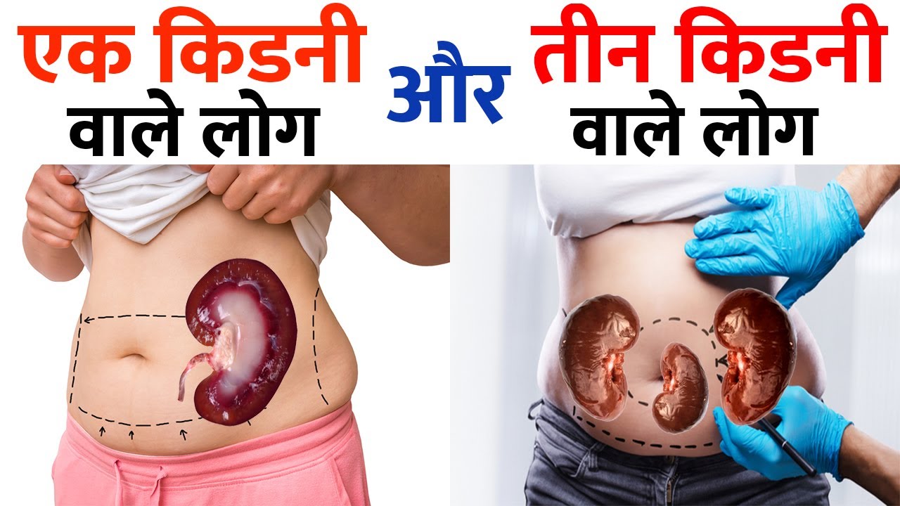 Born with Single Kidney | One Kidney Life | Man with Three Kidneys  एक या तीन किडनी पर जीने वाले लोग