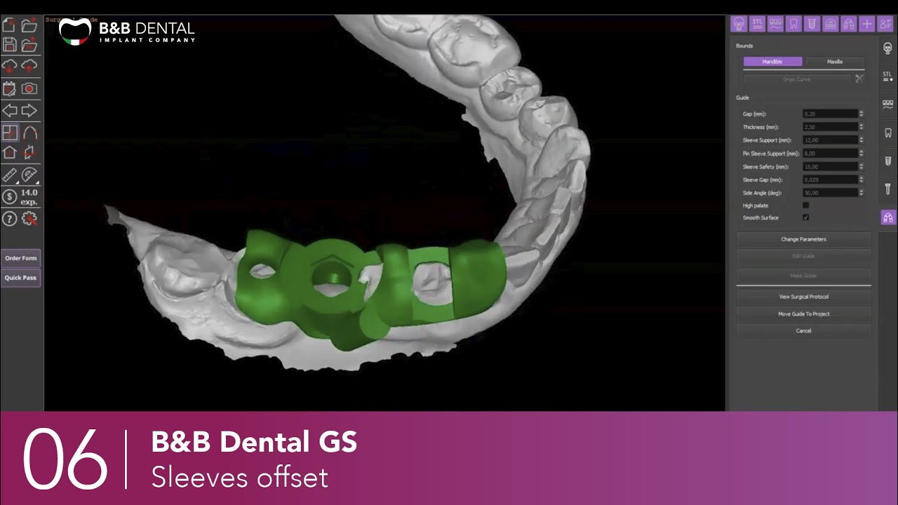 B&B Dental GS - 06 - Sleeves offset
