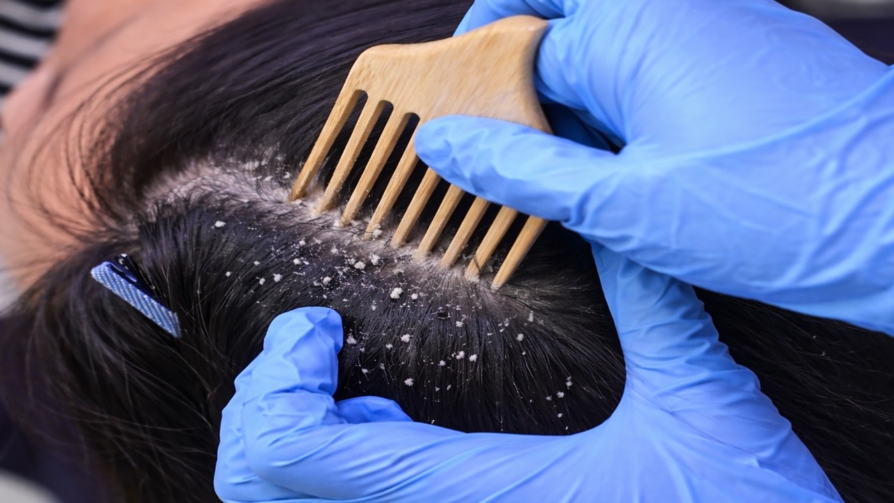 Clean Hair & Scalp Therapy | ASMR Calm Sounds for Full Relaxation