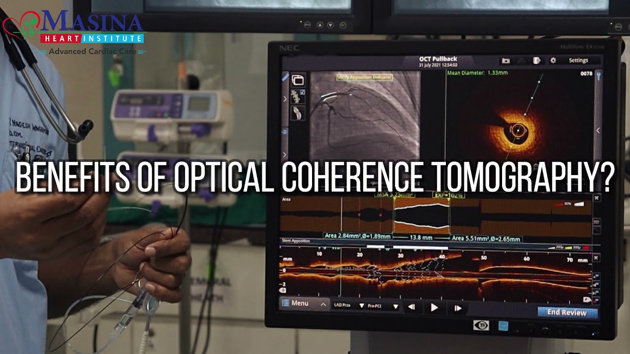 Optical Coherence Tomography(OCT) in Interventional Cardiology